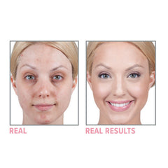 Super Moisturizing Anti-Wrinkle Cream