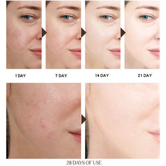 Rejuvenating Anti-Aging Moisturizing Skin Cream
